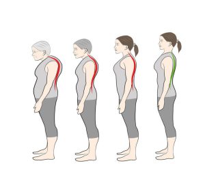 bone-density-and-height-correlation-4