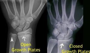 when-do-boys-stop-growing2